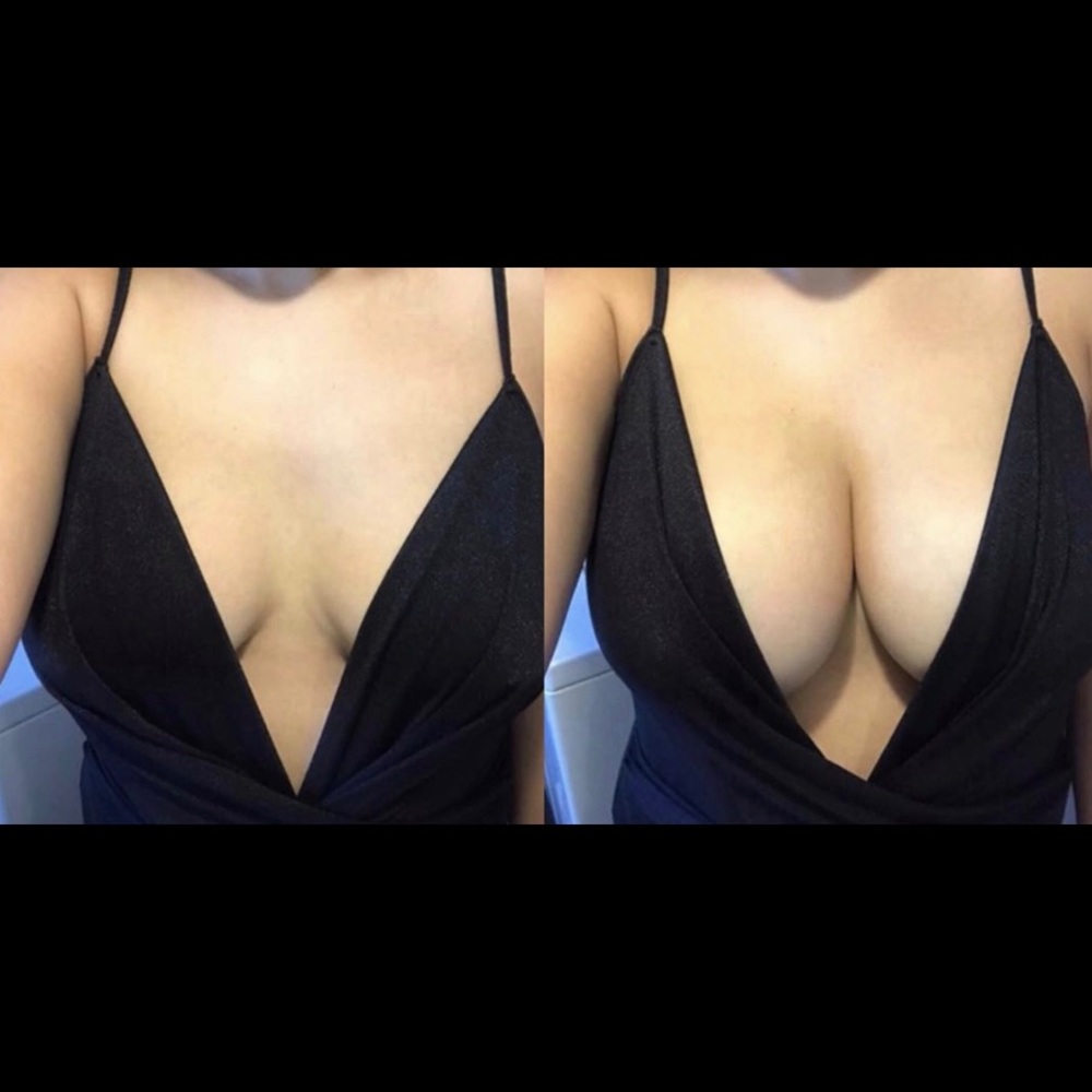 MISSES KISSES Bra-Frontless | Backless | Strapless